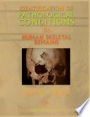 Identification of pathological conditions in human skeletal remains /